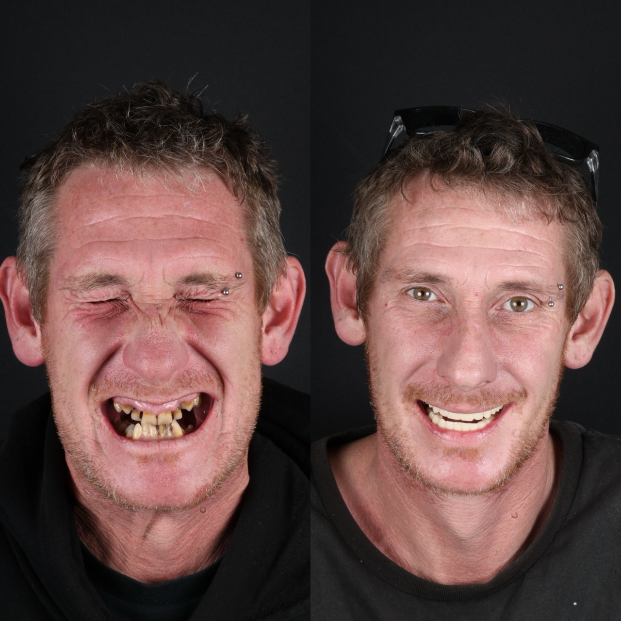 Before & After