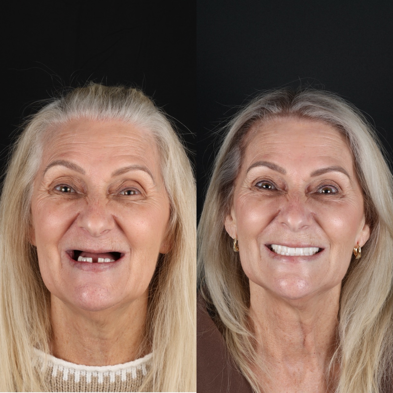 Before & After