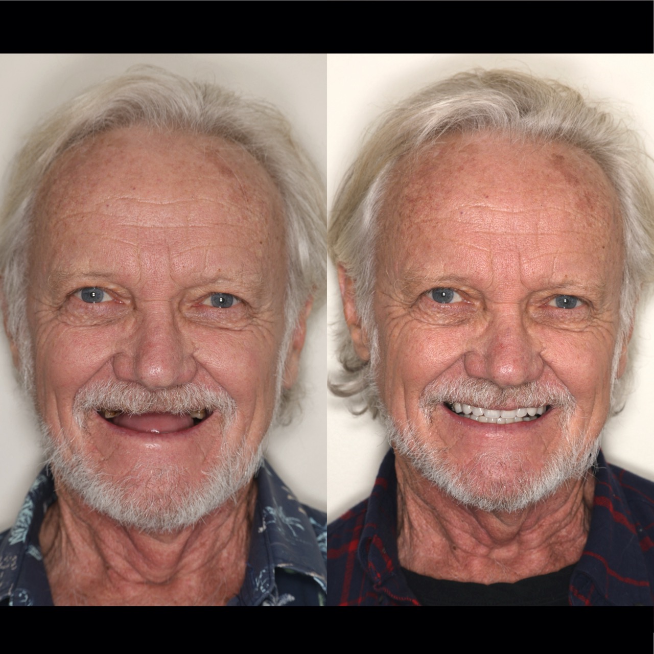 Before & After