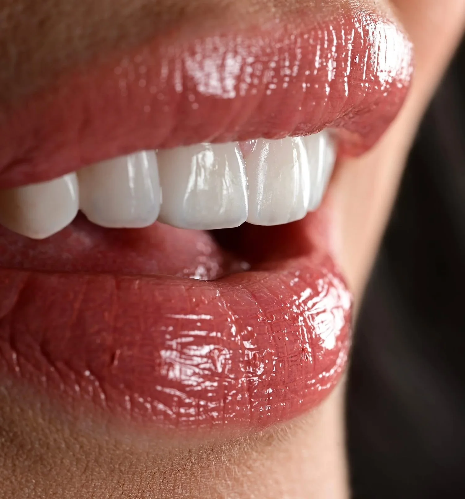 Single Tooth Implant